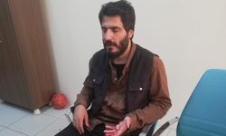 Bursa'da şehir eşkıyaları müdürün burnunu kırdı!
