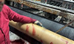 Elini makinaya kaptırdı, ağır yaralandı