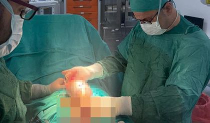 İdrar şikayetiyle gitti, tümör çıktı